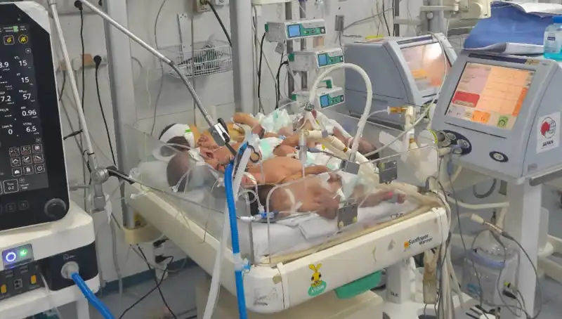 Gazze'deki Doktorlardan Çarpıcı İtiraf: "Kuvözlerde Birden Fazla Bebek Var"