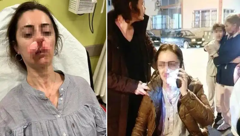 Eşinin Sevgilisi Sandığı Kapıyla Saldırdı! Olayın Şaşırtan Detayı