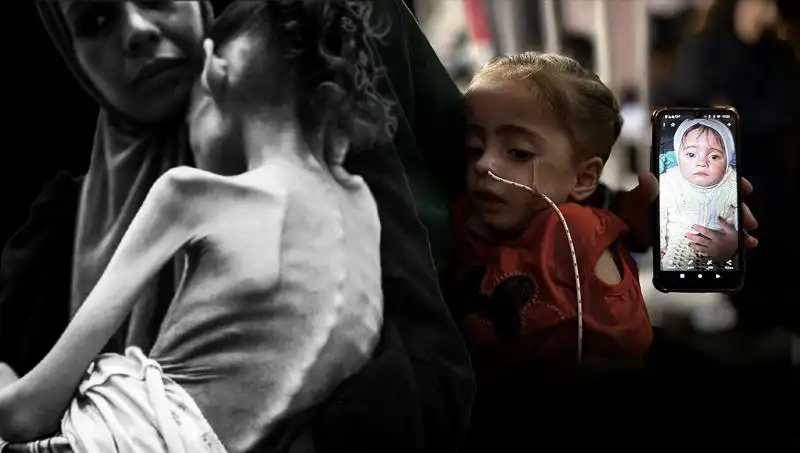 25 Kilodan 10 Kiloya Düşen Meryem’in Açlıkla Mücadelesi